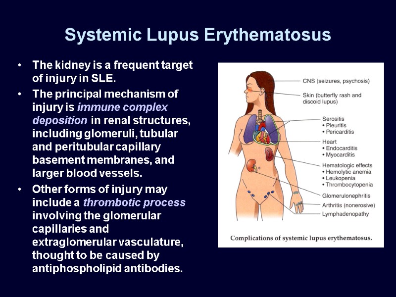 Systemic Lupus Erythematosus The kidney is a frequent target of injury in SLE. 